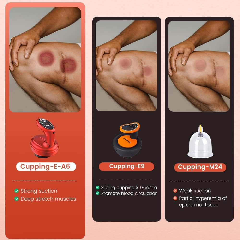 3 in 1 Cupping Set,Electric Cupping Therapy Machine,Powerful Suction Heating Cupping Massager,Electronic Cupping Device,Rechargeable Adjustable Handheld Cupping Massage Tool for Back Body